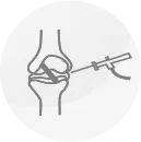 Ligament Reconstruction