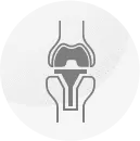 Total and Partial Knee Replacement 