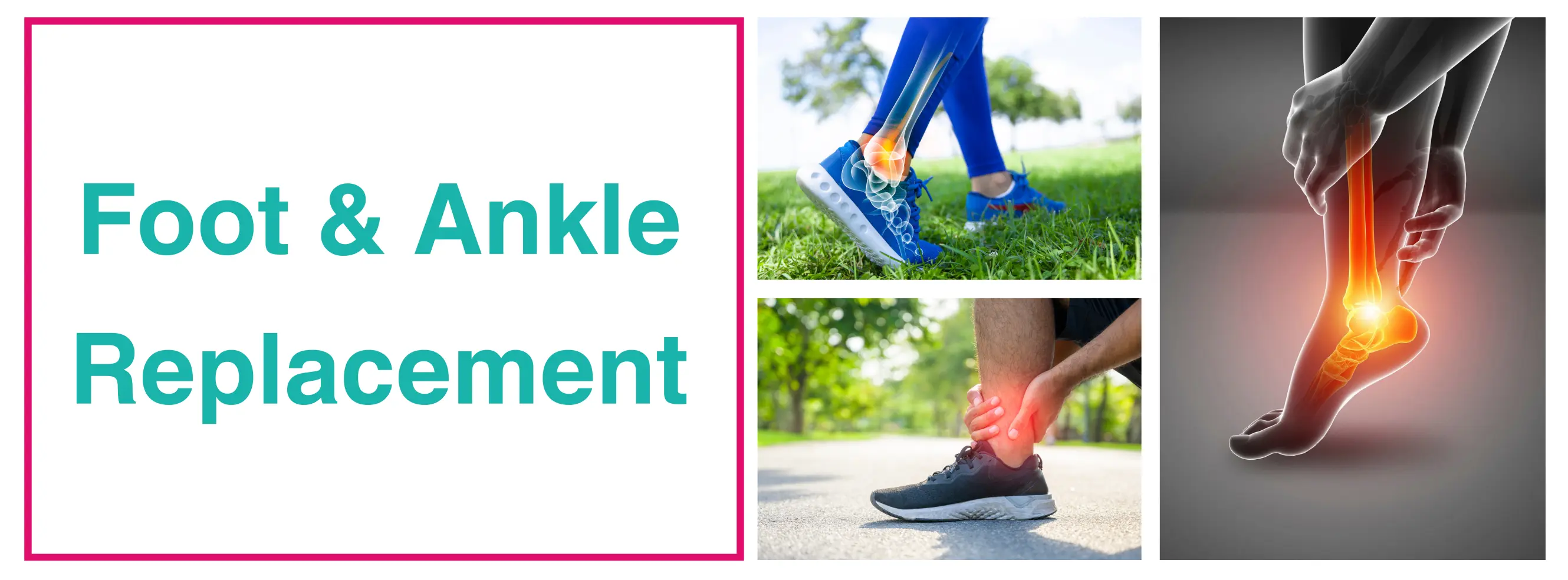 Foot & Ankle Surgeon In Delhi | Ankle Replacement saket