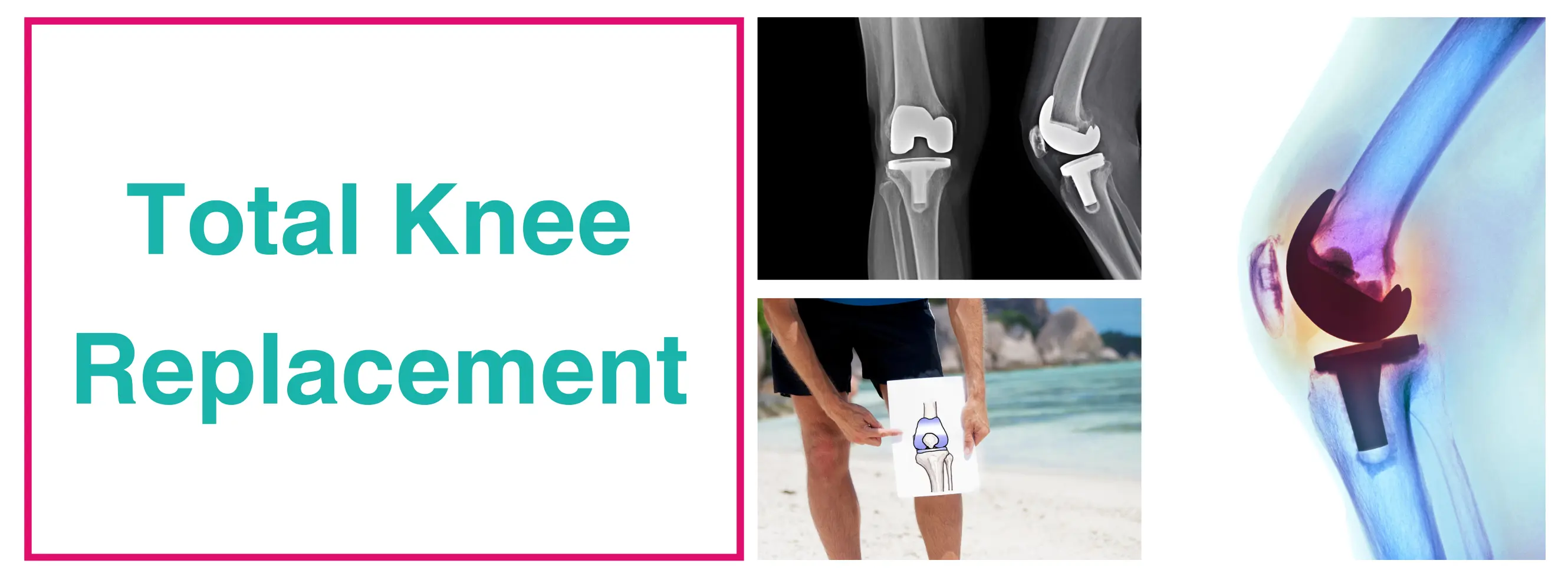 Best Knee Replacement Surgeon In Delhi | Knee Surgery Cost 2026