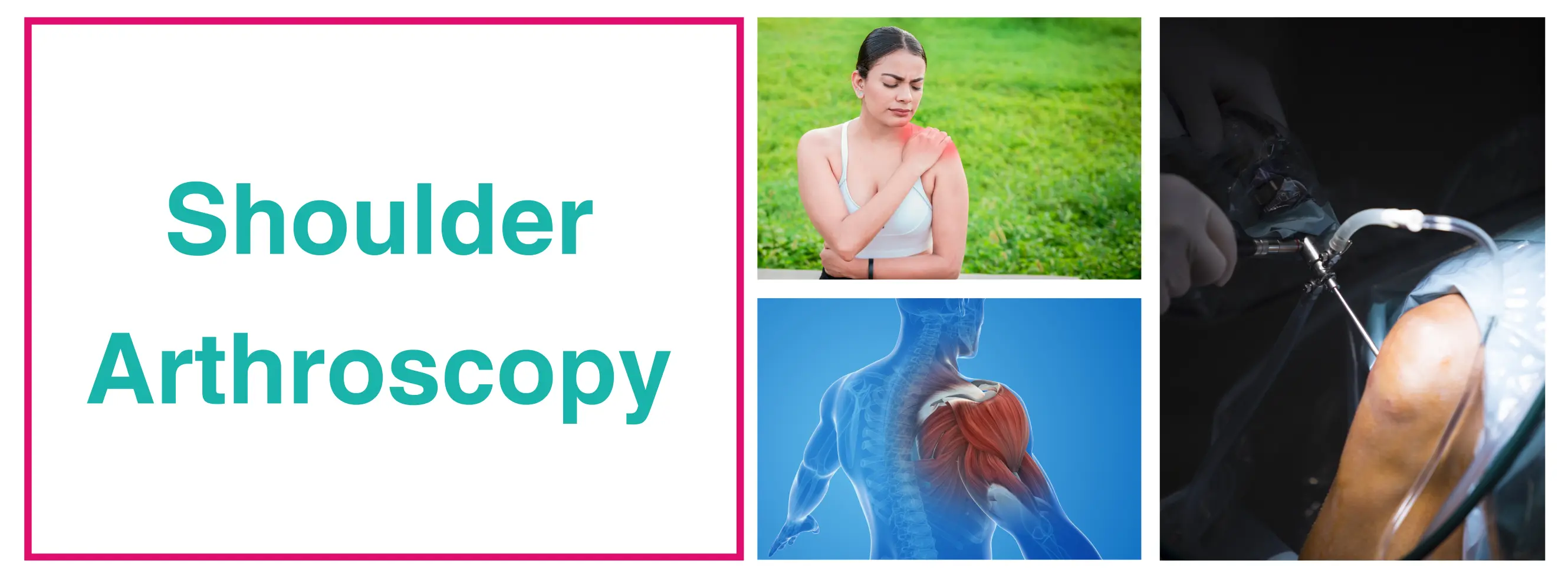 Shoulder Arthroscopy Surgery In Delhi | Best Surgeon - Dr. Sankalp Pande 