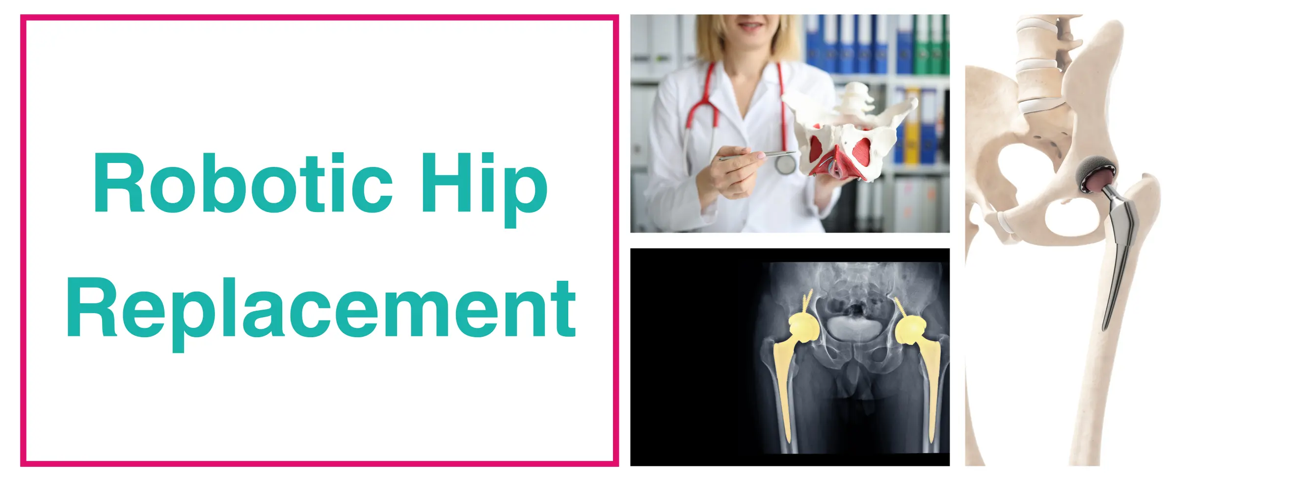 Robotic Hip Replacement Surgeon In Delhi - Dr. Sankalp Pande