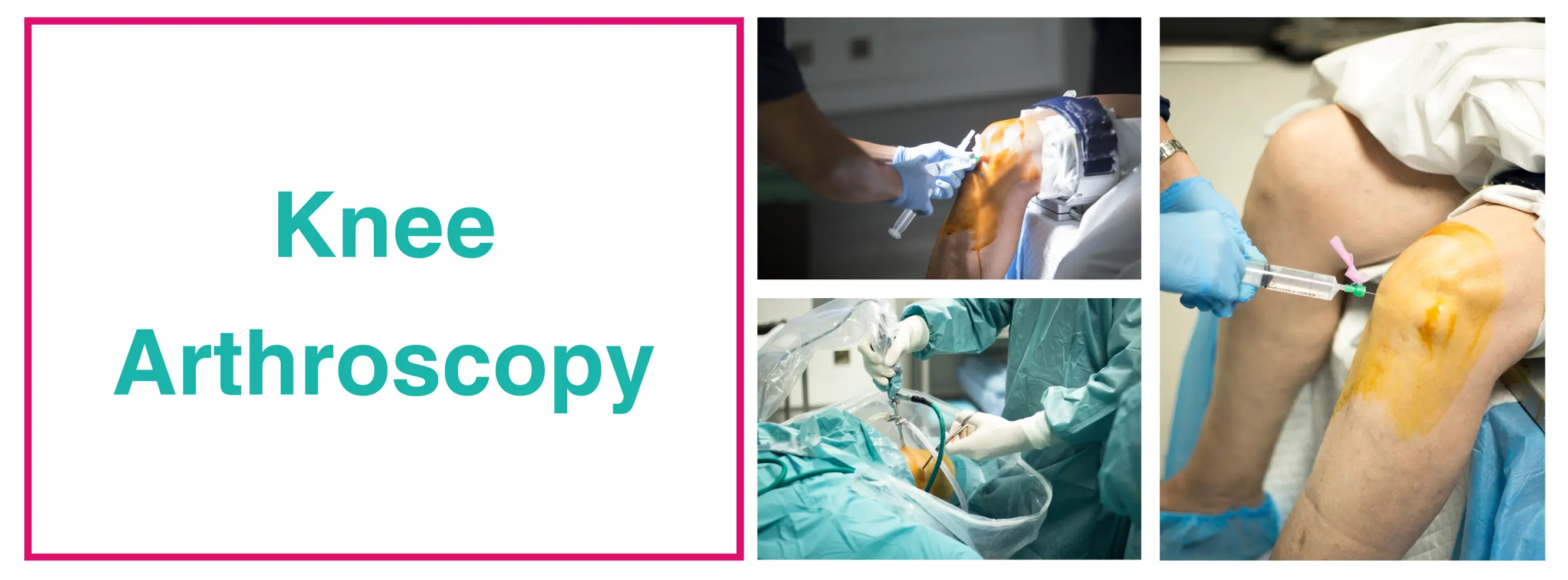 Knee Arthroscopy Surgery In Delhi | Best Knee Arthroscopy Doctor