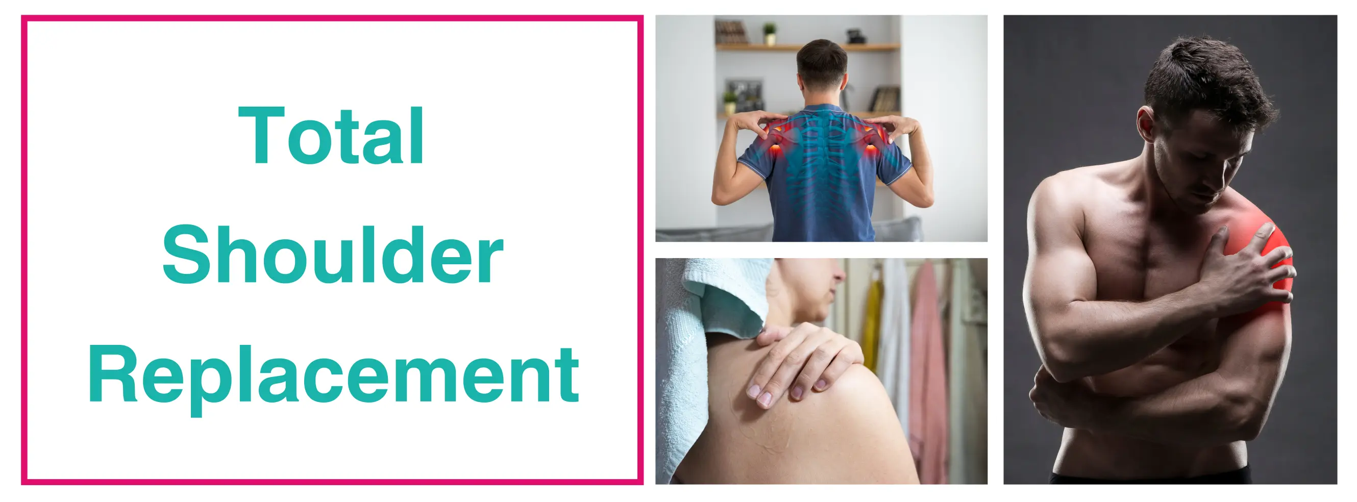 Total Shoulder Replacement In Delhi | Best Surgeon In Delhi