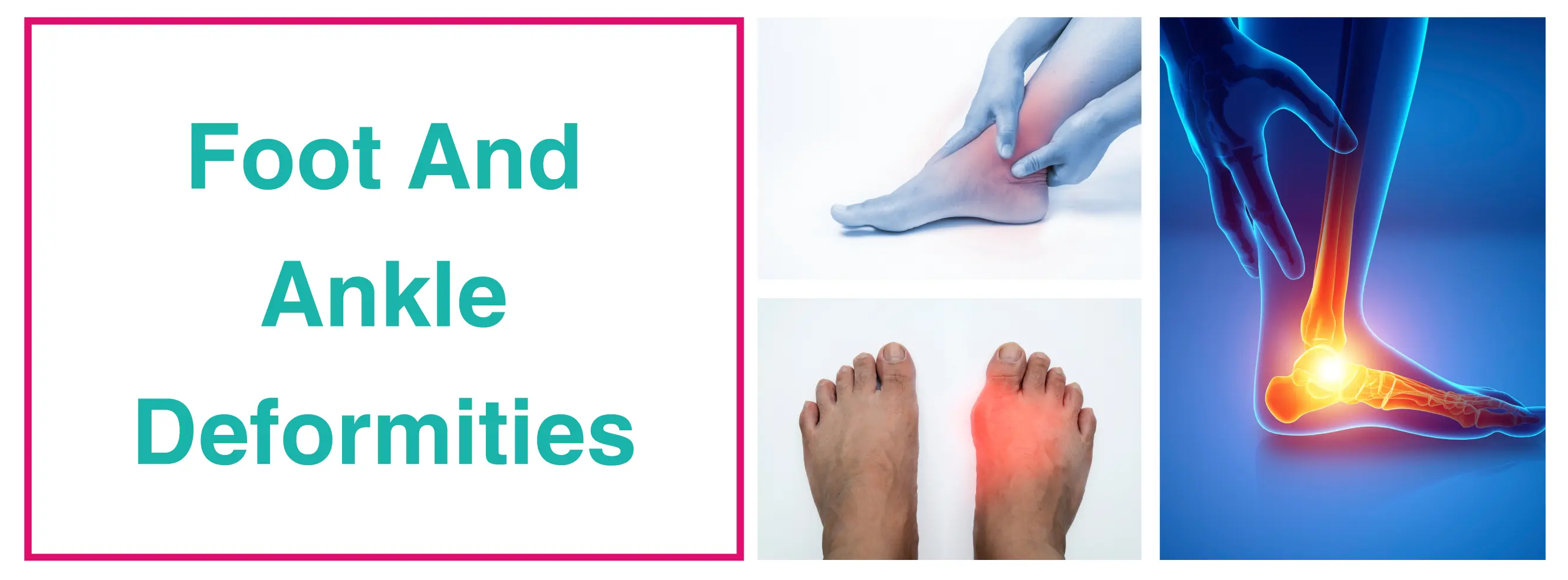 Understanding Foot & Ankle Deformities: Causes, Treatment
