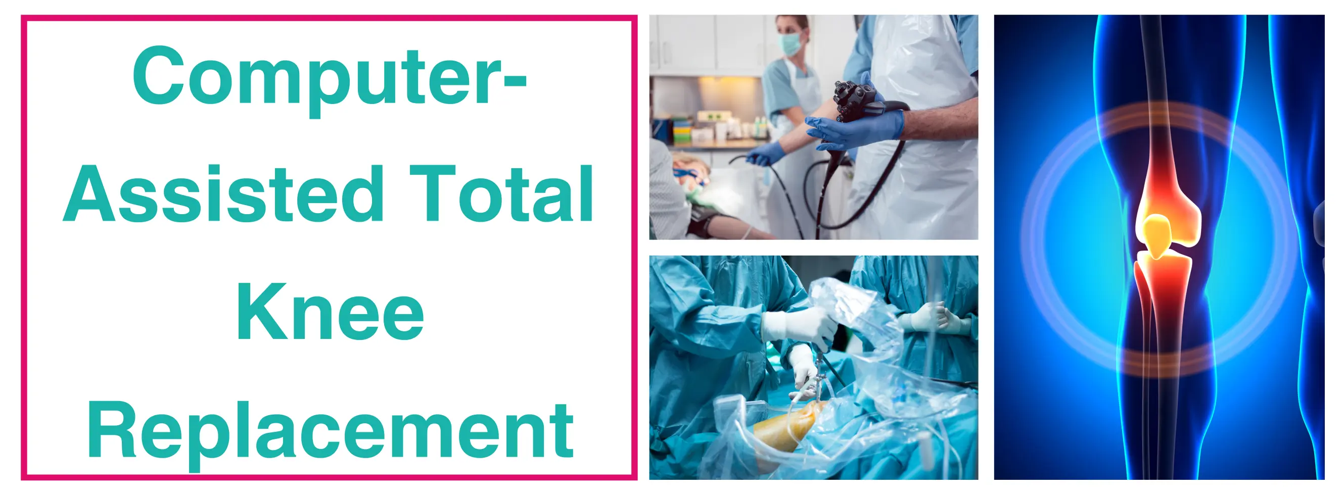 Computer Assisted Total Knee Arthroplasty | Dr. Sankalp Pande