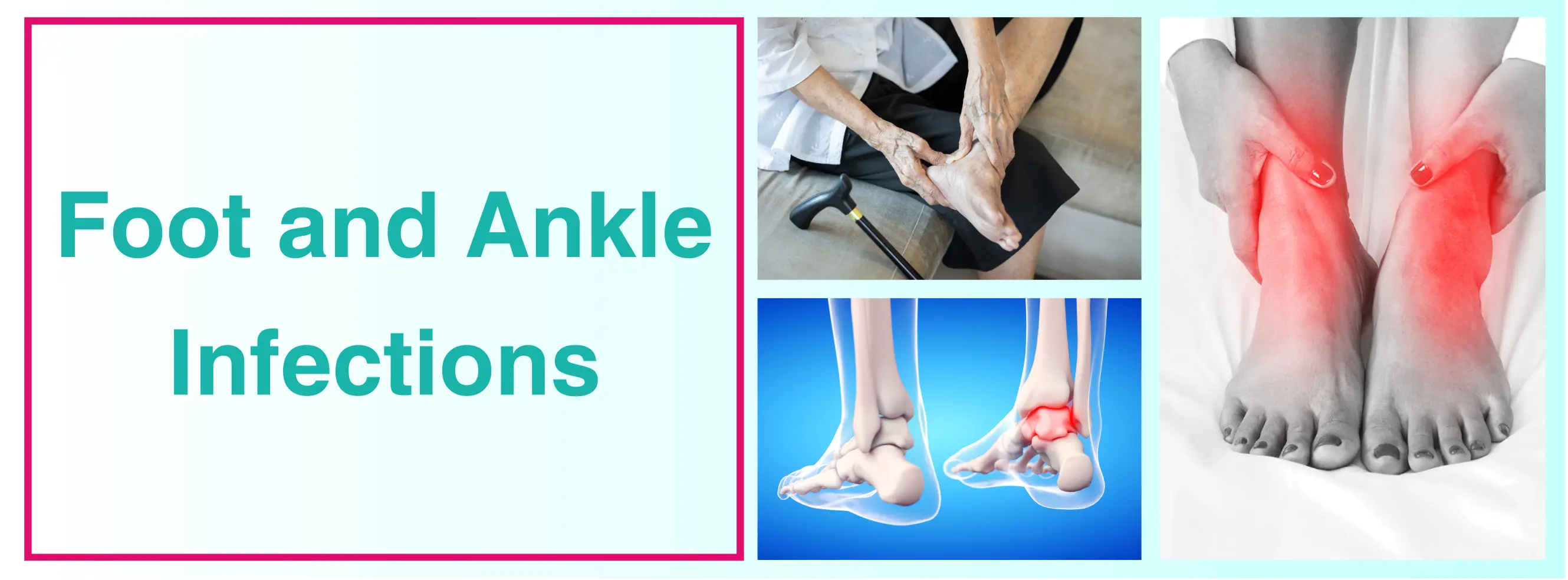 Navigating Foot And Ankle Infections: Diagnosis And Treatment