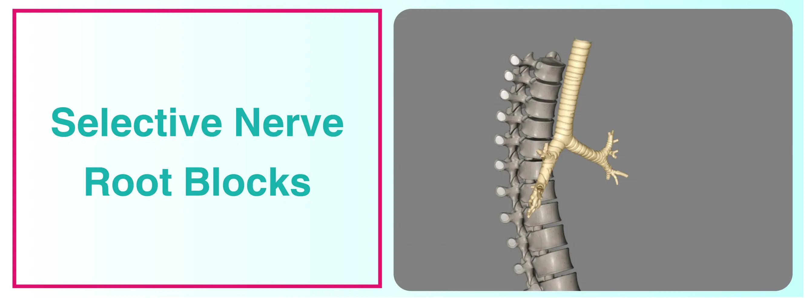 Selective Nerve Root Block For Spinal Pain Management